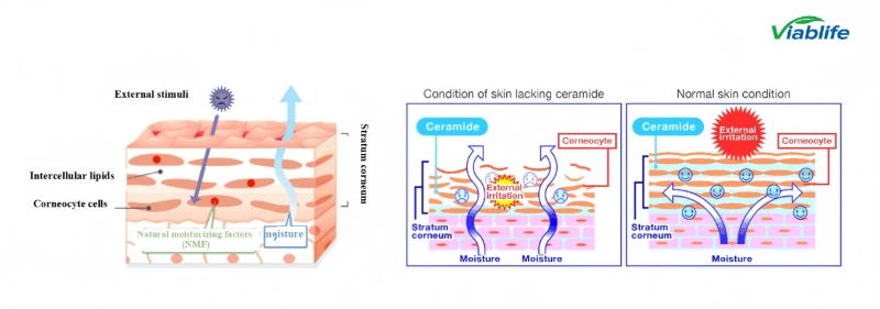 니코틴아마이드와 각질층 지질 Nicotinamide and Stratum Corneum Lipids